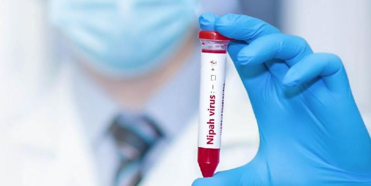 Ahli Kesehatan Dorong Pendekatan Singapura untuk Lindungi Indonesia dari Ancaman Virus Nipah