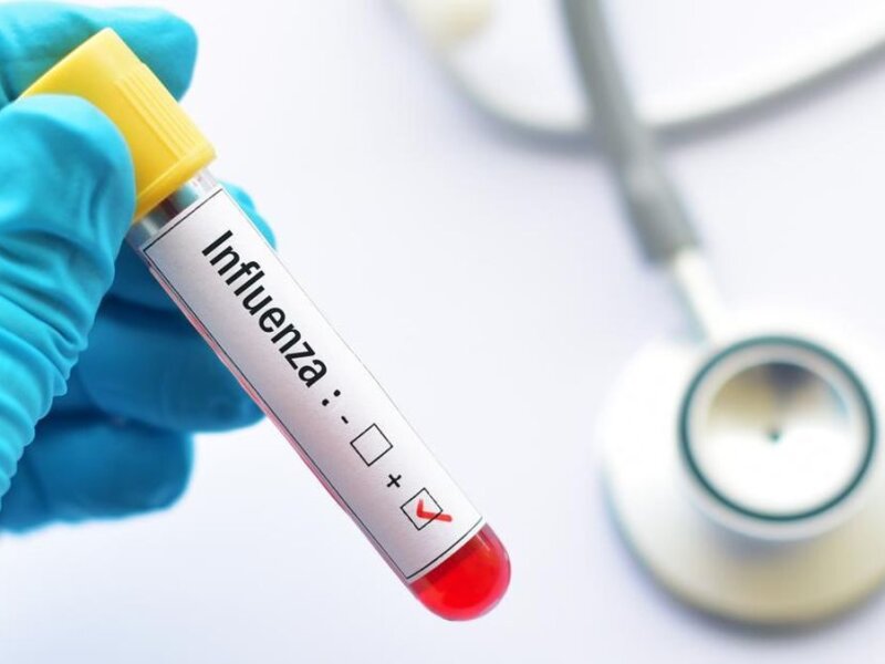 62 Kasus Super Flu Terdata di Indonesia, Kemenkes Pastikan Kondisi Terkendali